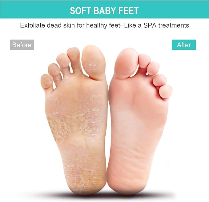 BESKAR XL Larger Shower Foot Scrubber Mat with Non-Slip Suction Cups | Cleans, Smooths, Exfoliates, Massages Your Feet Without Bending, Improve Foot Circulation, Soothes Tired Feet