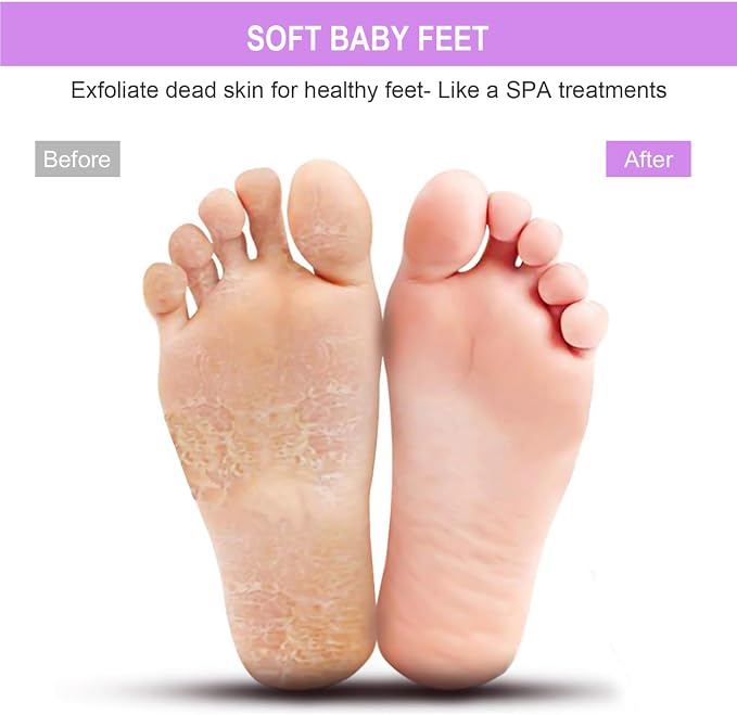 BESKAR XL Larger Shower Foot Scrubber Mat with Non-Slip Suction Cups | Cleans, Smooths, Exfoliates, Massages Your Feet Without Bending, Improve Foot Circulation, Soothes Tired Feet