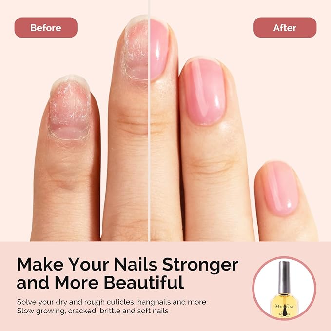 MelodySusie No Wipe Glossy Top Coat Base Coat Cuticle Oil Set Long Lasting Shine Finish Soak Off UV LED Nail Lamp Nail Art Design Manicure Kit Perfect Gifts for Women Girls 3 Pcs 15ml