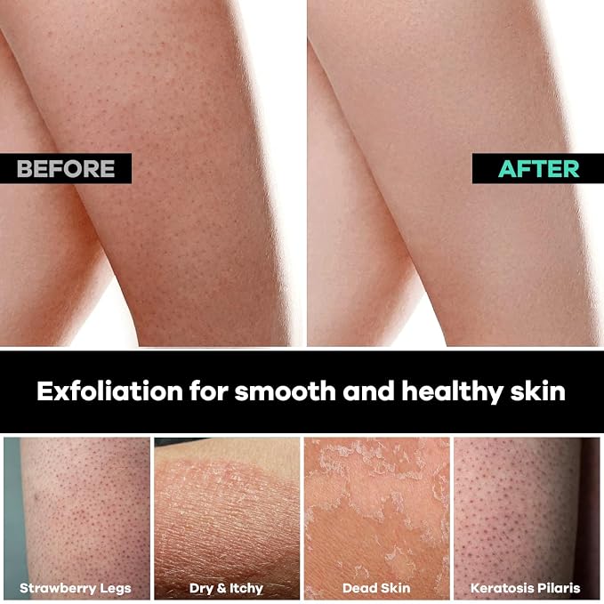 Dermasuri - Deep Exfoliating Body Scrub & Foot Scrub Set Bundle - Shower Body Exfoliator Glove, Spa Exfoliation Mitt & Exfoliating Feet Spray - Dry Skin Remover Sole File - Skin Care Spa Treatment Pro