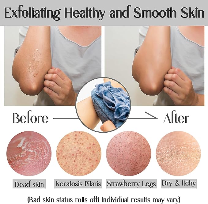 Deep Exfoliating Mitts (2pcs) Double-Sided Gloves for Shower, Body Massage Scrub & Bath Loofah Sponge，Skin Exfoliator, Dead Skin Remover (Pink & Blue)